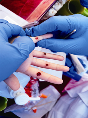 挑疳积治疗小孩积食